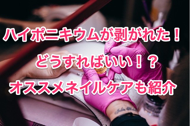 ハイポニキウムが剥がれる時の対処法を解説 ネイルケアのおすすめオイルも紹介 知恵の海